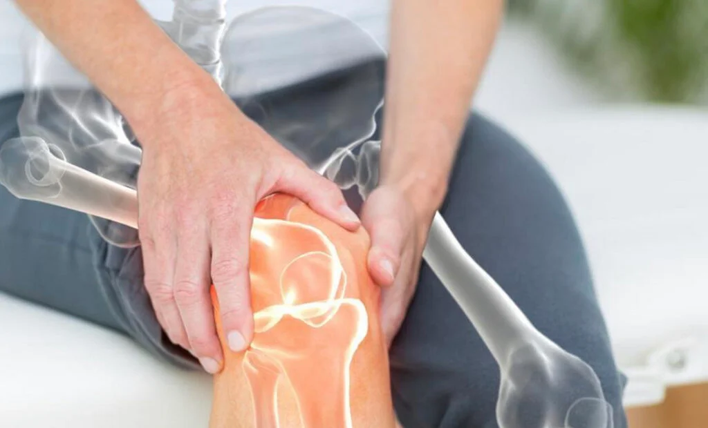 kolano szkoczka rentgen